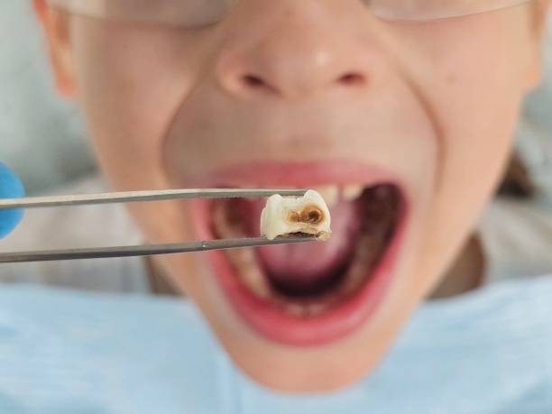 Best Emergency Care for Gum Disease in Ford City, CA